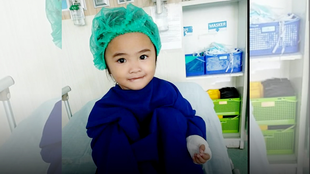 Usai Operasi, Kondisi Alexa Balita Penderita Tulang Kaki Keropos Mulai Membaik