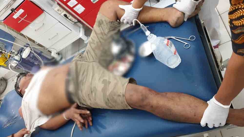 Pelaku curanmor yang ditembak polisi di Dharmasraya