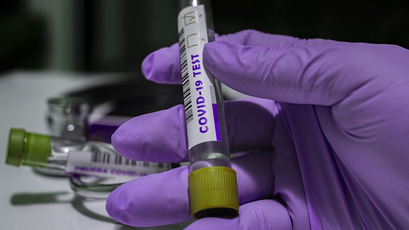 Warga Dharmasraya Tes Swab