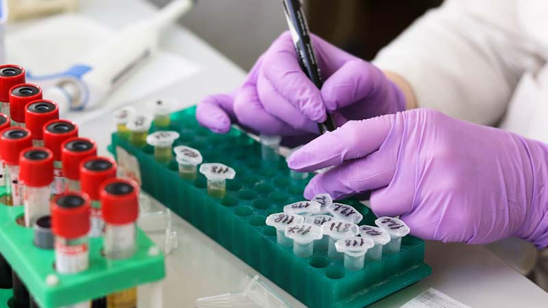 Tertahan di Bea Cukai, Stok Reagen untuk Periksa Corona di Labor Unand Menipis