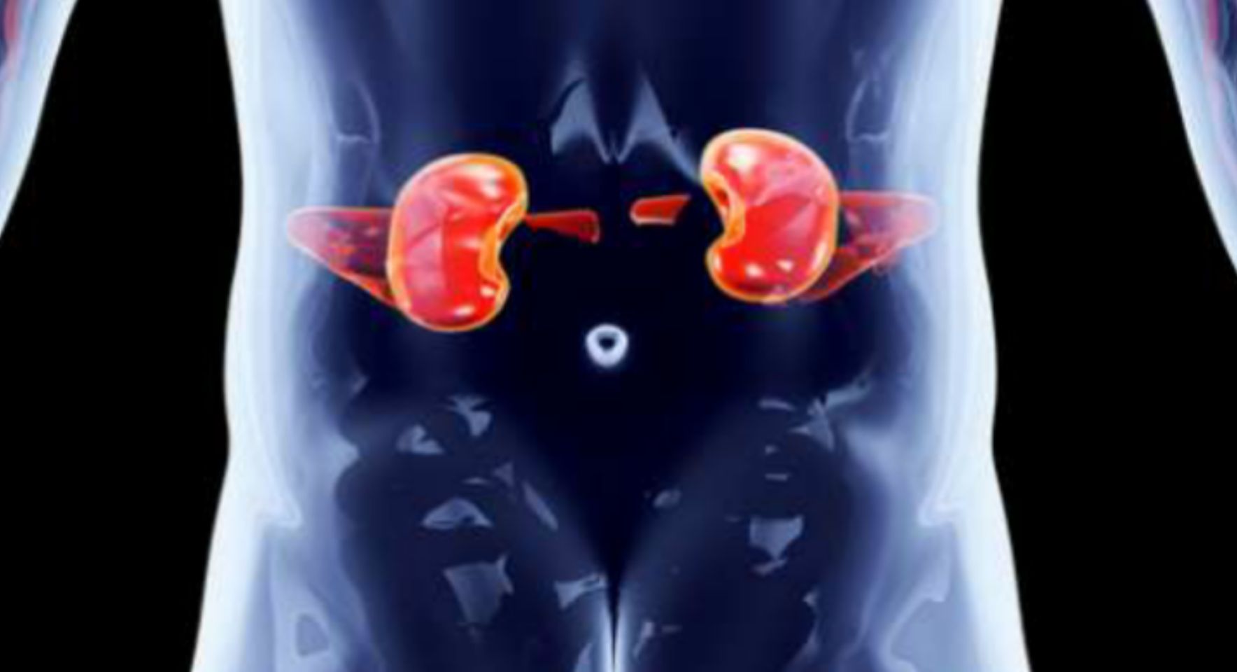 Sering Berkeringat Setiap Tidur Malam? Waspadai Gejala Kanker Ginjal