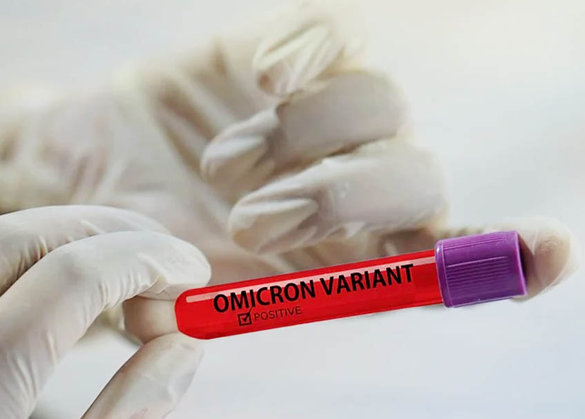 Berita Padang - berita Sumbar terbaru dan terkini hari ini: 14 pasien Omicron yang dirawat di RSUP M Djamil Padang rata-rata belum divaksin.