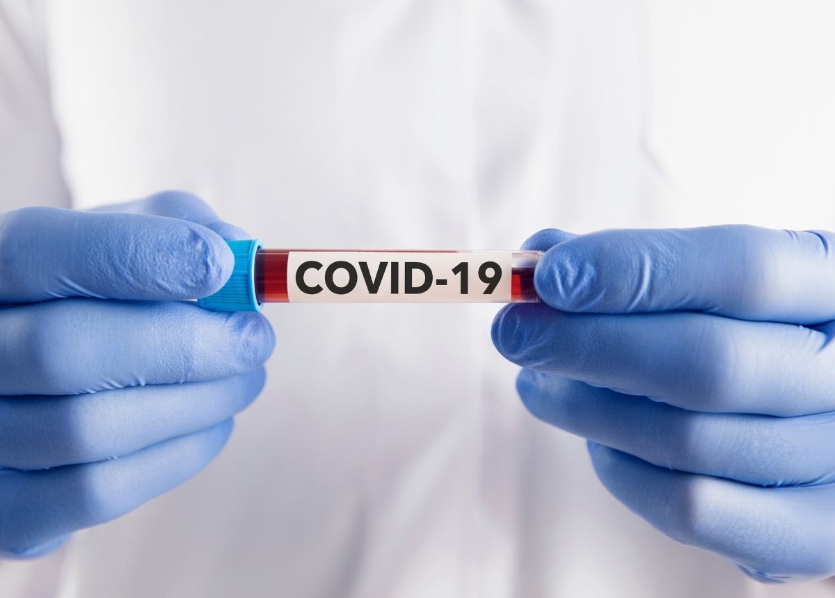 Berita Sumbar terbaru dan terkini hari ini: 594 kasus baru covid-19 bertambah di Sumbar sehingga total ada 94.687 orang warga terinfeksi.