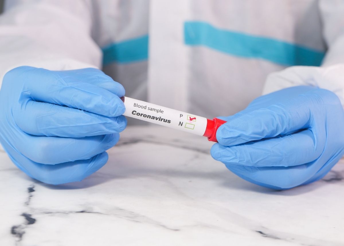 Berita Sumbar terbaru dan terkini hari ini: Hari ini sebanyak 20 kasus baru covid-19 bertambah di Sumbar. Pasien sembuh bertambah 40 orang.