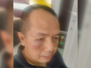 Wakil Ketua Kesatuan Pedagang Pasar (KPP) Pasar Raya Padang, Sumatra Barat (Sumbar) Irsal Mawardi menjadi korban dugaan pemukulan yang terjadi di belakang Koppas Plaza, Pasar Raya Padang.