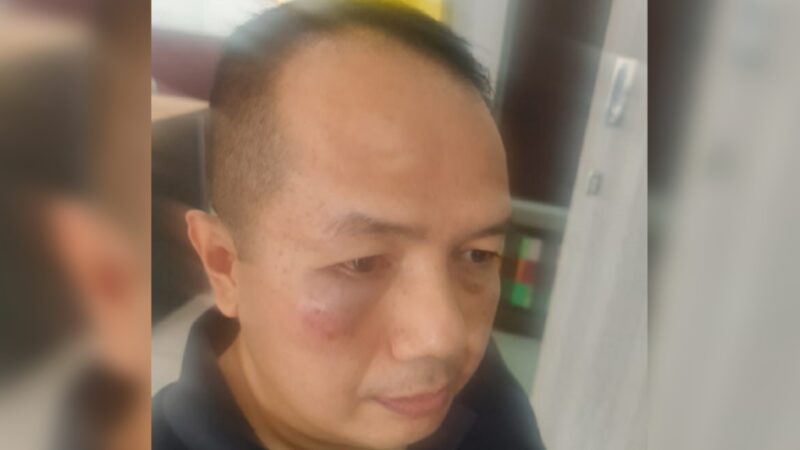 Wakil Ketua Kesatuan Pedagang Pasar (KPP) Pasar Raya Padang, Sumatra Barat (Sumbar) Irsal Mawardi menjadi korban dugaan pemukulan yang terjadi di belakang Koppas Plaza, Pasar Raya Padang.